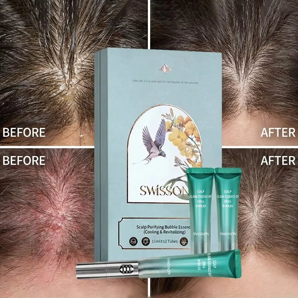 SWISSON Scalp Purifying Bubble Essence